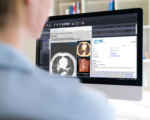 Visualizador de diagn&oacute;stico m&eacute;dica olhando para imagens RM de Perfus&atilde;o