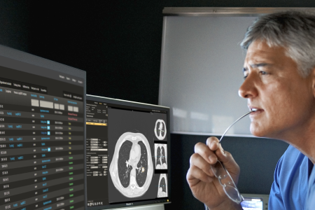 Solu&ccedil;&otilde;es de tratamentos para o pulm&atilde;o