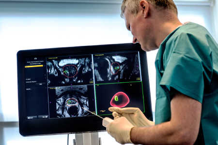 Solu&ccedil;&otilde;es para o c&acirc;ncer de pr&oacute;stata