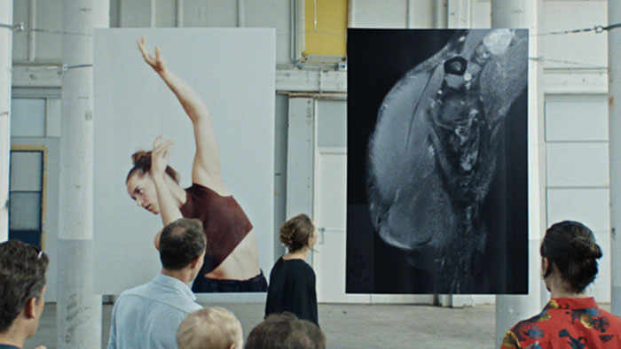 Pessoas analisando uma grande imagem cl&iacute;nica