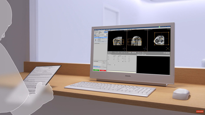 V&iacute;deo mostrando o Philips SmartWorkflow em a&ccedil;&atilde;o