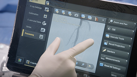 Apresentando a nova gera&ccedil;&atilde;o do Azurion da Philips para radiologia intervencionista