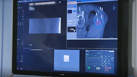 Testemunho de cliente do Azurion 7 C20 da Philips no St. Antonius, em Nieuwegein, Pa&iacute;ses Baixos