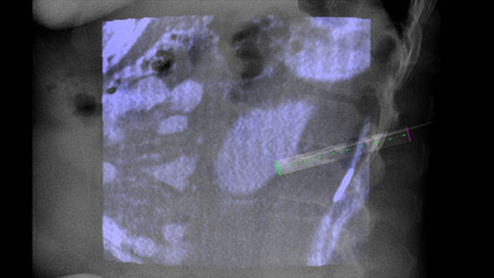 Orienta&ccedil;&atilde;o de trajet&oacute;ria ao vivo com o XperGuide