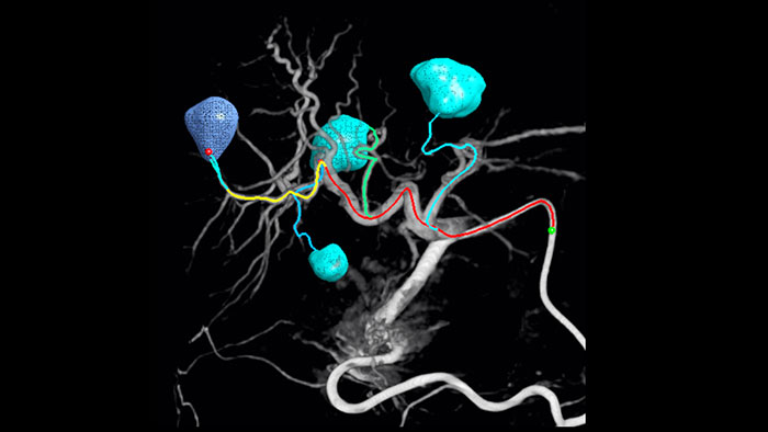 Navega&ccedil;&atilde;o por imagem EmboGuide