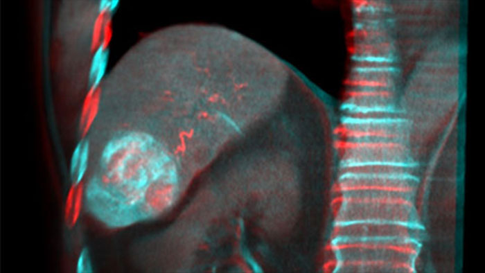 Fus&atilde;o de imagens com o recurso Dual View