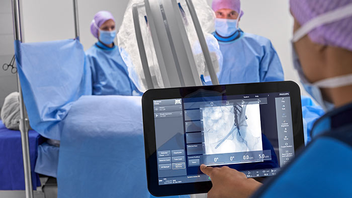 Mem&oacute;ria de posicionamento