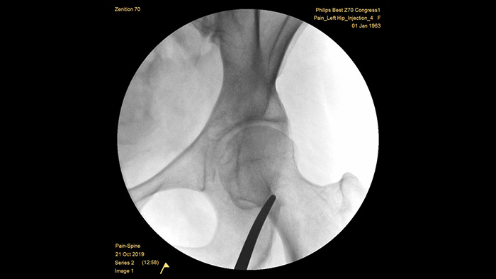 Aprimoramento autom&aacute;tico da imagem