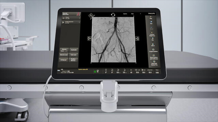 Processamento vascular