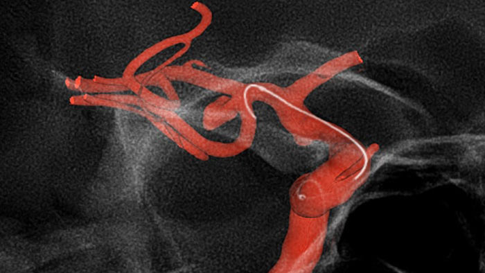 Visualiza&ccedil;&atilde;o aprimorada do Roteiro SmartCT