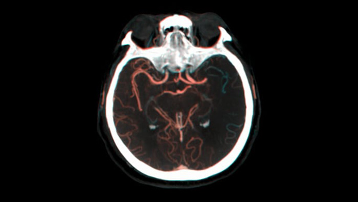 Visualiza&ccedil;&atilde;o do preenchimento colateral