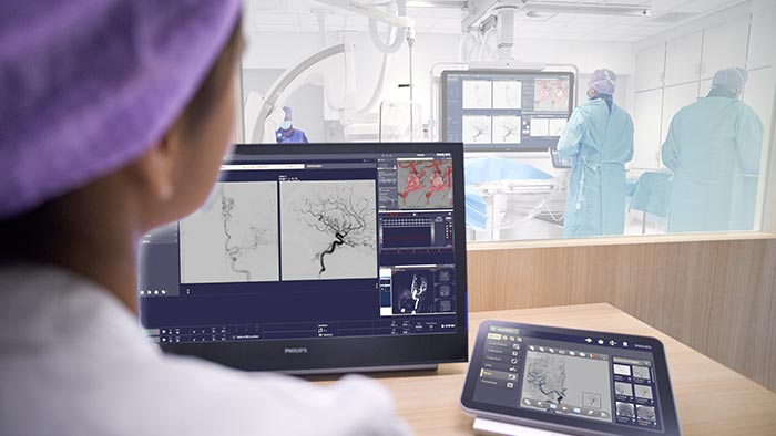 Atendimento neurovascular