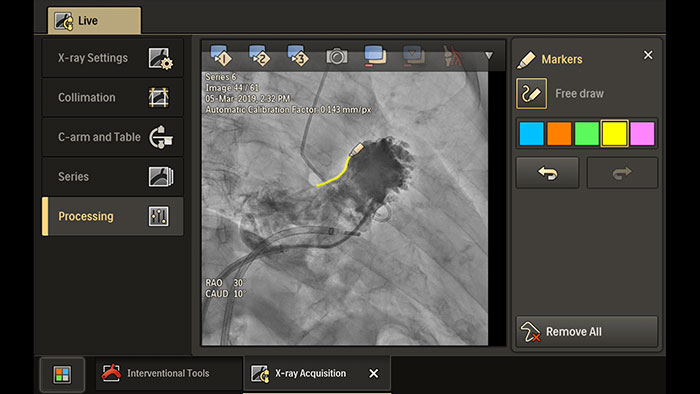Solu&ccedil;&otilde;es de fluxo de trabalho do Azurion