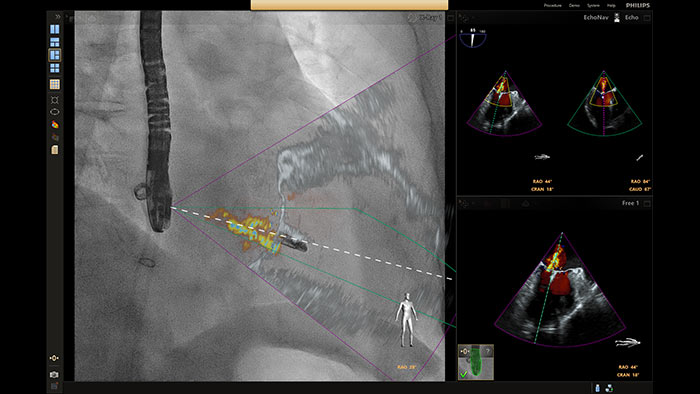 Fus&atilde;o MClip com Xplane