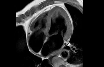 Card&iacute;aco image