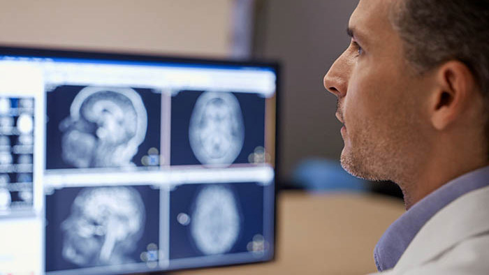 Experimentando a import&acirc;ncia do Compressed SENSE