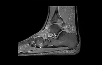 Musculoesquel&eacute;tico image