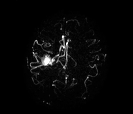 Imagens em v&iacute;deo do 4D-TRANCE