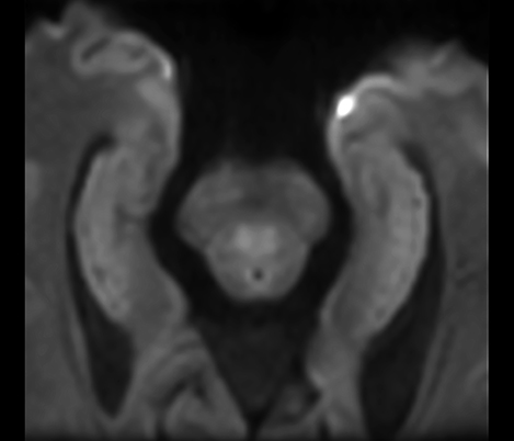 Imagens em v&iacute;deo do Zoom Diffusion