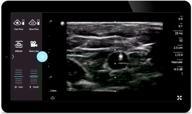 Reduzir complica&ccedil;&otilde;es