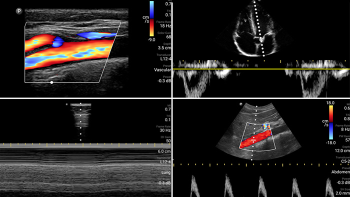 Imagem de primeiro caso