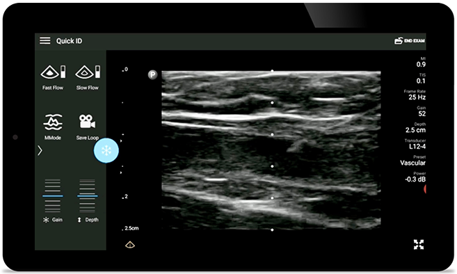 Diminuir complica&ccedil;&otilde;es 