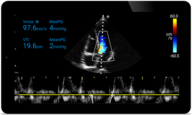 Agir mais r&aacute;pido para proteger o cora&ccedil;&atilde;o deles