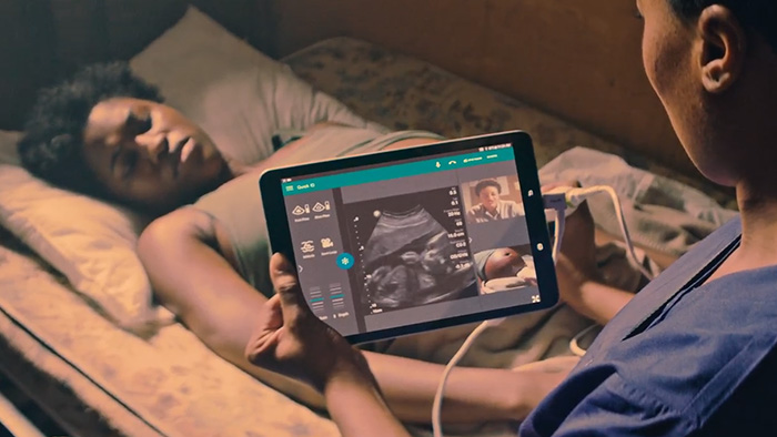 Teleultrassom integrado Lumify alimentado pelo Reacts &mdash; captura de v&iacute;deo