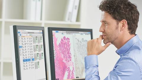 aumentando-a-precis&atilde;o