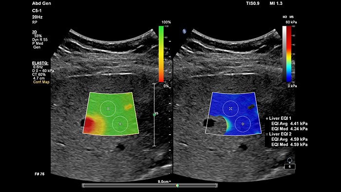 ec&oacute;grafo epiq 7