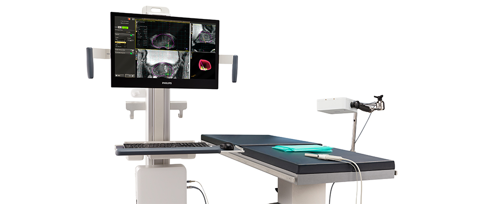 UroNAV Configura&ccedil;&atilde;o r&aacute;pida e f&aacute;cil