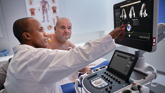 A Philips lança o Transcend Plus para EPIQ CVx e Affiniti CVx, oferecendo qualidade de imagem inovadora e melhorias em IA aprovados pelo FDA para ultrassom cardiovascular