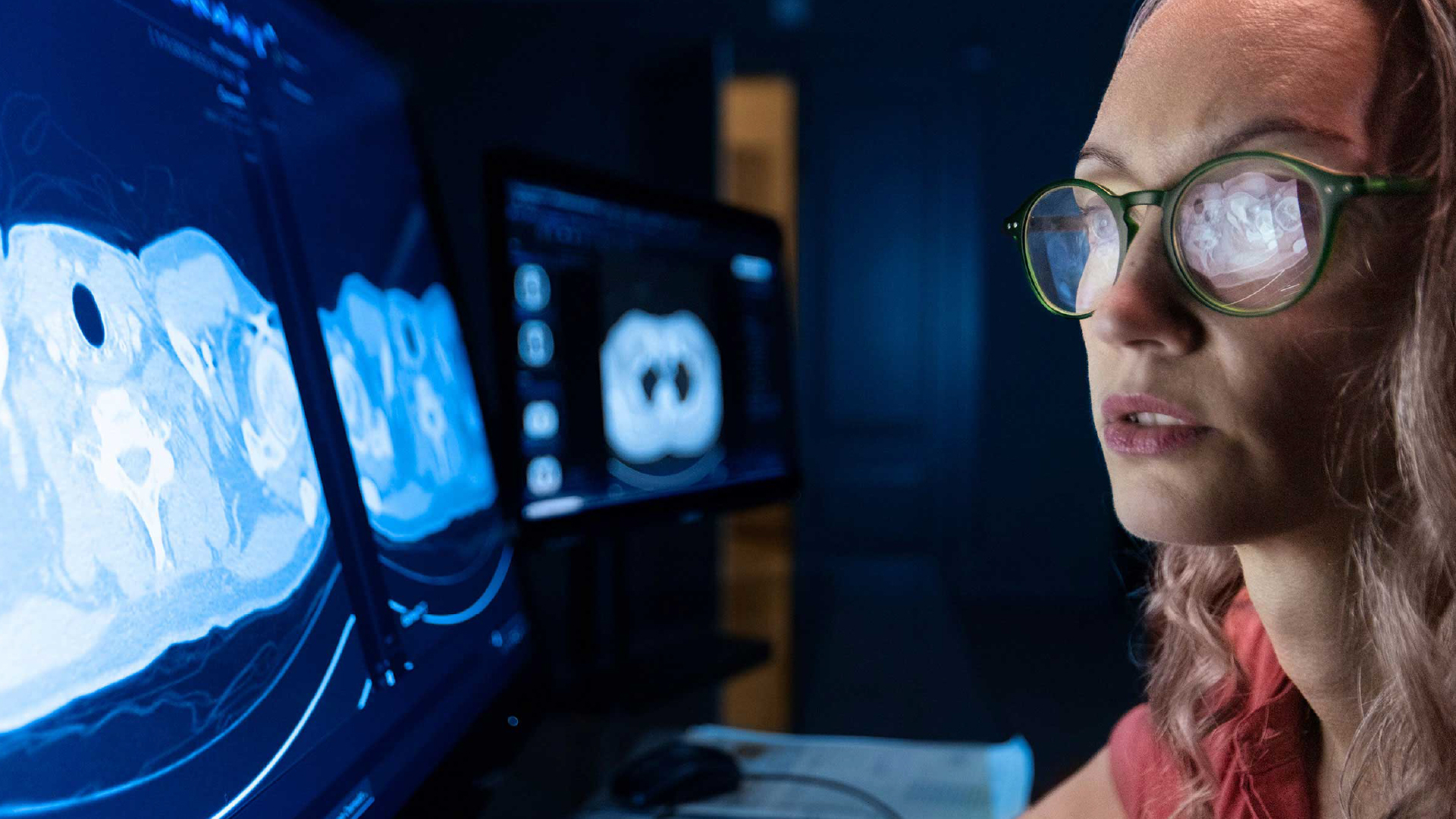 Philips reforça a sua estratégia de Integrated Diagnostics no Brasil para reduzir a fragmentação e acelerar as decisões clínicas