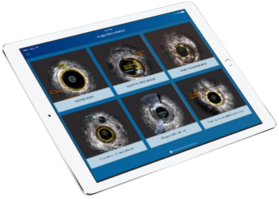 iPad de um especialista em IVUS