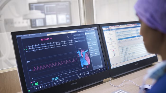 Hemodin&acirc;mica com a esta&ccedil;&atilde;o de trabalho IntelliVue X3