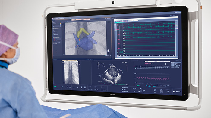 Procedimentos de fibrilação atrial