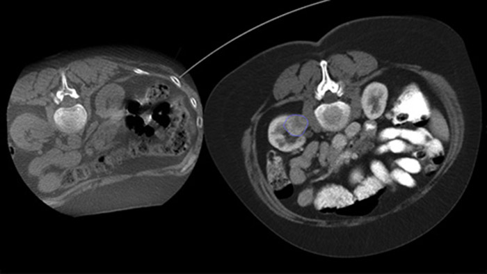 Diagnóstico por imagem CBCT