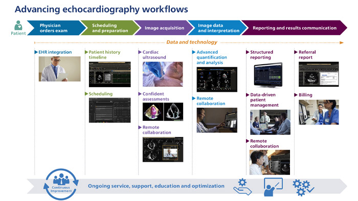 Avan&ccedil;ando fluxos de trabalho de ecocardiografia