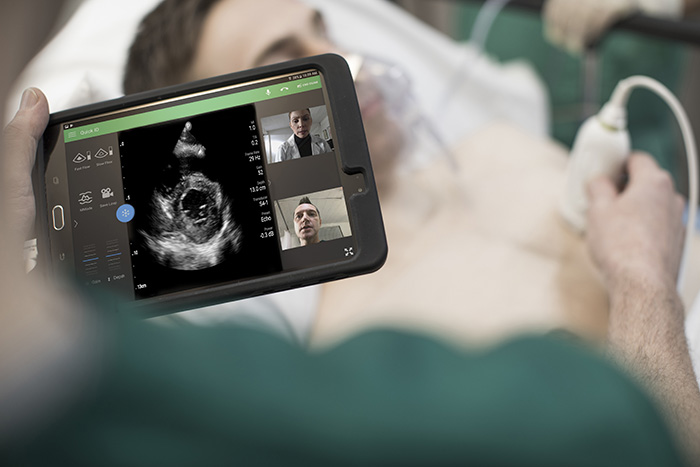 FDA autoriza uso de ultrassons Philips em pacientes com complica&ccedil;&otilde;es pulmonares e card&iacute;acas relacionadas &agrave; COVID-19
