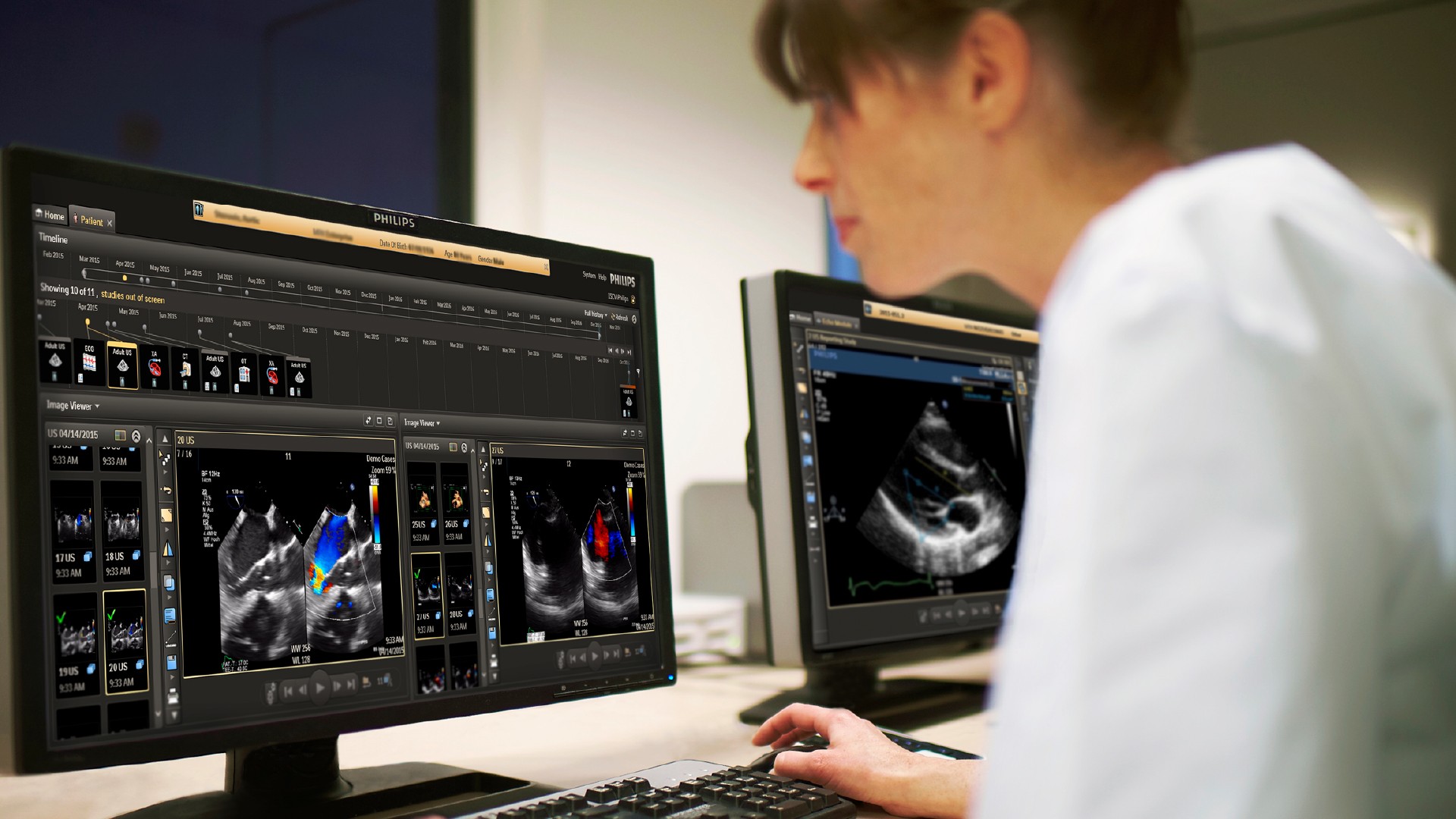 Conex&atilde;o entre imagens, dados cl&iacute;nicos e fluxos assistenciais transforma a jornada diagn&oacute;stica em Cardiologia